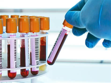 laboratory analysis exeter|exeter hospital blood lab.